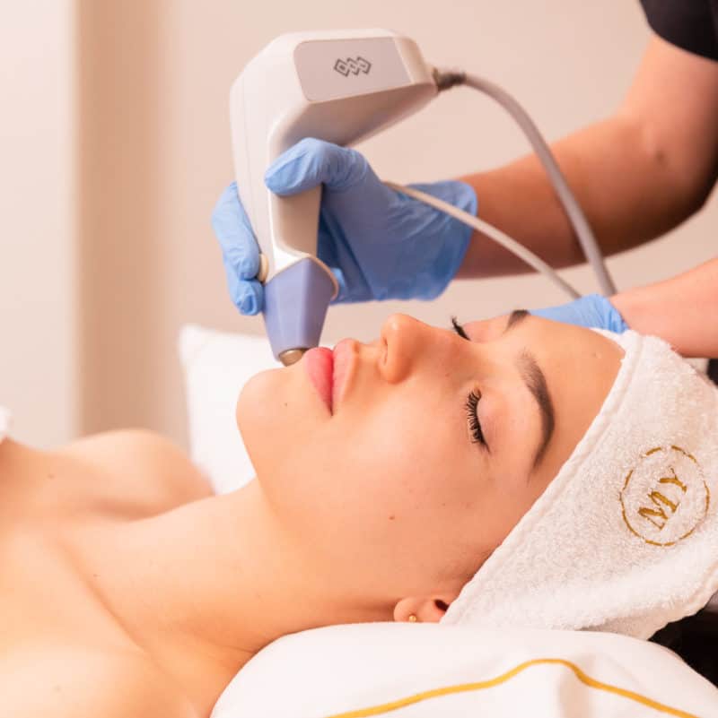 Exilis Facial