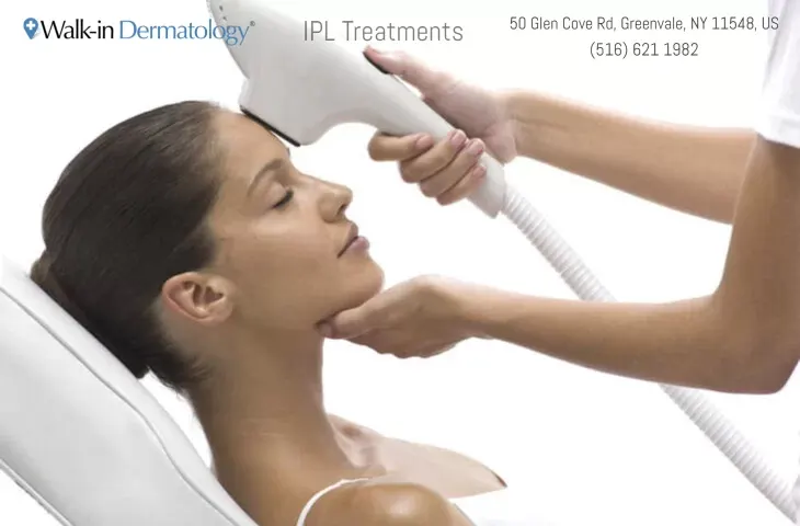IPL Facial (Fotorejuvenecimiento)